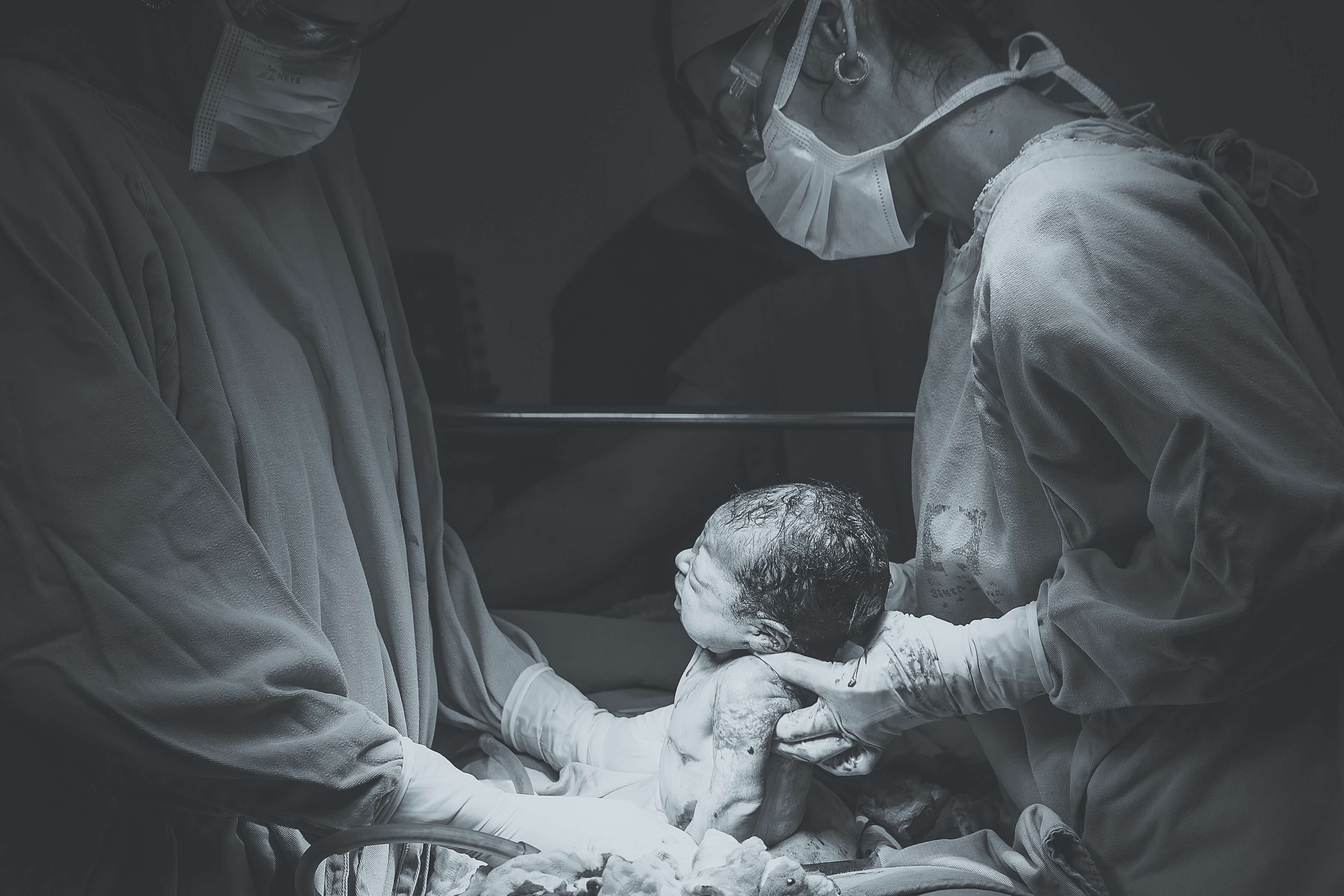 greyscale photo of medical operation with newborn baby